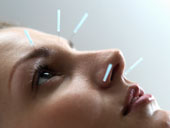 akupunktur gesicht
